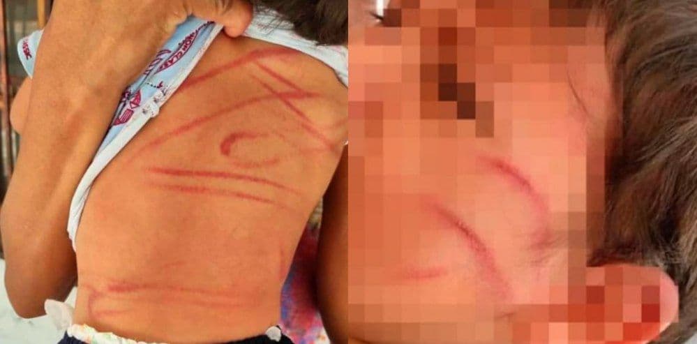 Propinan brutal golpiza a niño de 2 años por dañar el cobertura de un celular.