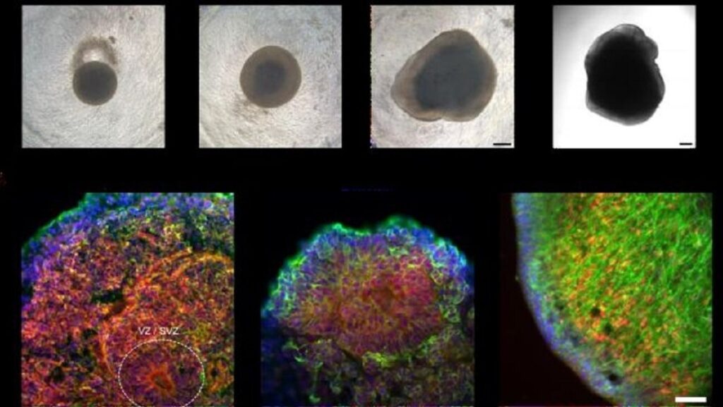 ordenador cerebro neurona organoide