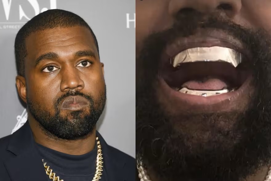 kanye west dentadura West rapero