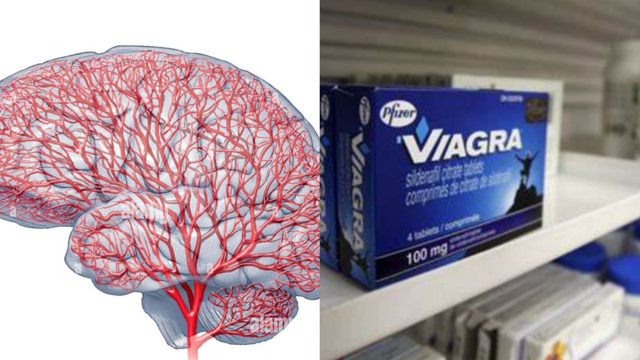 La viagra ayuda a prevenir la demencia al aumentar el flujo sanguíneo del cerebro