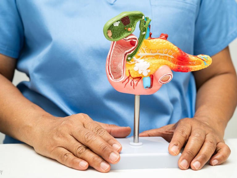 cáncer de páncreas